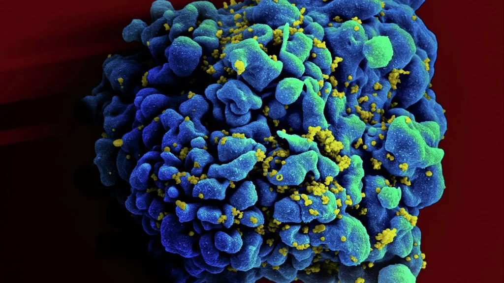 Tìm Ra Phương Pháp Điều Chế Vắc Xin Hiệu Quả Chống Lại Hiv