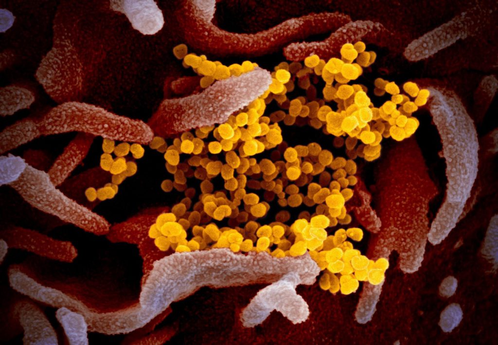 Các Nhà Khoa Học Trung Quốc Thử Nghiệm Công Nghệ Phát Hiện Coronavirus Trong Không Khí